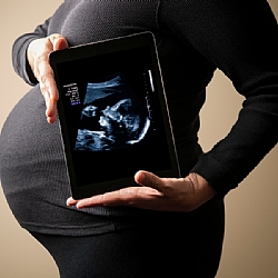 אולטרסאונד נשים